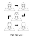 Stages of Hair Loss in Men Card Poster. Vector
