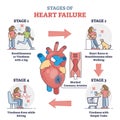 Stages of heart failure and symptoms with cardiology stroke outline diagram