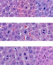 Stages of liver cellular mitosis