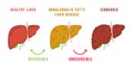 Stages of liver diseases. Medical infographic. Vector illustration