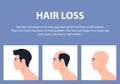 Stages of male baldness. Hair loss. Alopecia. Royalty Free Stock Photo