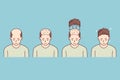 Stages of man hair transplant