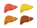 Stages of nonalcoholic liver damage. Healthy, fatty and cirrhosis. Liver Disease.