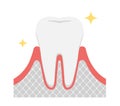 The stages of periodontitis disease illustration / Healthy tooth