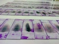 Stained glass slides of peripheral blood smear with violet Leishman giemsa stain is isolated in hematology department Royalty Free Stock Photo