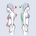 Standing woman poor good posture infographic vector illustration