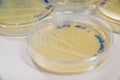 Staphylococcus aureus culture