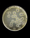 Staphylococcus aureus growing on Baird Parker