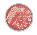 Staphylococcus aureus