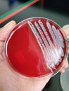 Staphylococcus bacteria on Blood Agar culture medium