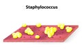 Staphylococcus colonies