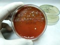 Staphylococcus and growth on blood agar. fungus mixed growth Royalty Free Stock Photo