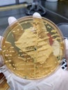 Staphylococcus saprophyticus, sample culture - Microbiology