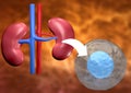 Stem cell therapy used to recover diseased kidney