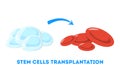 Stem cell transplntation to the blood cell