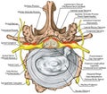 BOARD Stenosis, lumbar disk herniation
