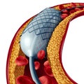Stent And Angioplasty Isolated