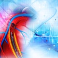 Stent angioplasty