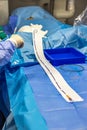 Stent and catheter for implantation into blood vessels with an empty and filled balloon. Metal stent for implantation and Royalty Free Stock Photo