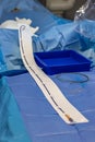 Stent and catheter for implantation into blood vessels with an empty and filled balloon. Metal stent for implantation and Royalty Free Stock Photo