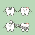 Step of decay tooth to teeth filling, before and after Royalty Free Stock Photo