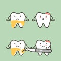 Step of teeth scaling - dental plaque removal, before and after