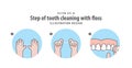 Step of tooth cleaning with floss illustration vector on blue ba