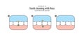 Step of tooth cleaning with floss illustration vector on white b