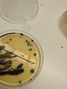 Bacteria Growing on Baird Parker Agar Royalty Free Stock Photo