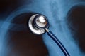 Stethoscope on Xray photo