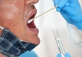 Stick with cotton swab to be inserted into elderly patient open mouth, tube for virus specimen transport held by hand in blue