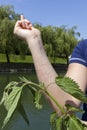 Stinging nettle allergic reaction Royalty Free Stock Photo