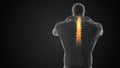 Neck joint and spine pain medical concept Royalty Free Stock Photo