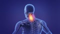 Animation of a painful neck