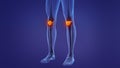 Anatomy of the human patella Royalty Free Stock Photo