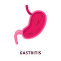 stomach ache gastric gastritis disease human organ healthcare medical symptom