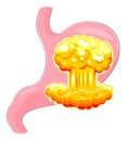 Stomach with an atomic explosion Royalty Free Stock Photo