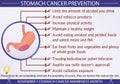 Stomach Cancer Prevention Infographic Vector Illustration