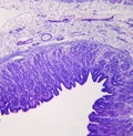 Stomach cross section-medium power