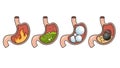 Stomach disease structure diagram medical science