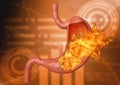 Stomach fire. excessive acidity, indigestion, stomach disease, gastric ulcer, severe abdominal pain