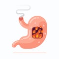 Stomach heartburn concept flat Royalty Free Stock Photo