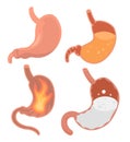 Stomach icons set, isometric style