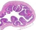 Stomach. Layers of the gastric wall