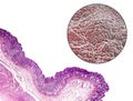 Stomach mucosa, micrograph and illustration