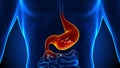 Stomach Pain - Gastric Acid - Reflux