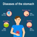 Stomach pain infografics