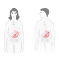 Stomach pain. Male and female silhouette with highlighted of stomach