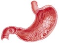 Stomach - Peptic Ulcers Royalty Free Stock Photo