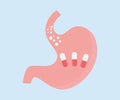 Stomach with pills logo design. Human stomach close up. Organ anatomy. Digestive system. Ulcer, cancer, gastritis, dysbiosis.